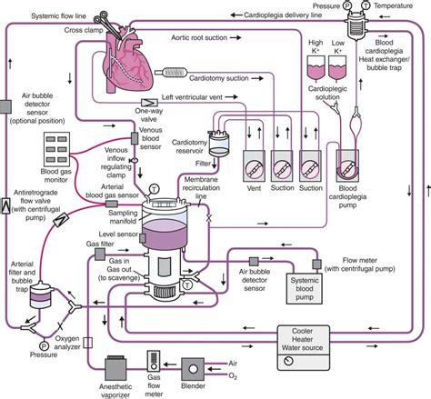 centrifugal pump system cardiopulmonary bypass|cardiopulmonary bypass circuit diagram.